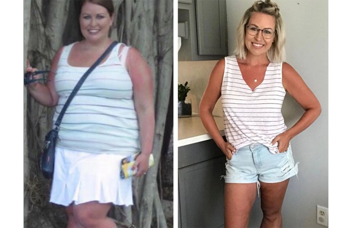 Weight loss